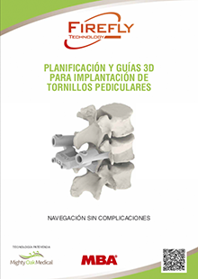 PLANIFICACIÓN Y GUIAS 3D PARA IMPLANTACIÓN DE TORNILLOS PEDICULARES